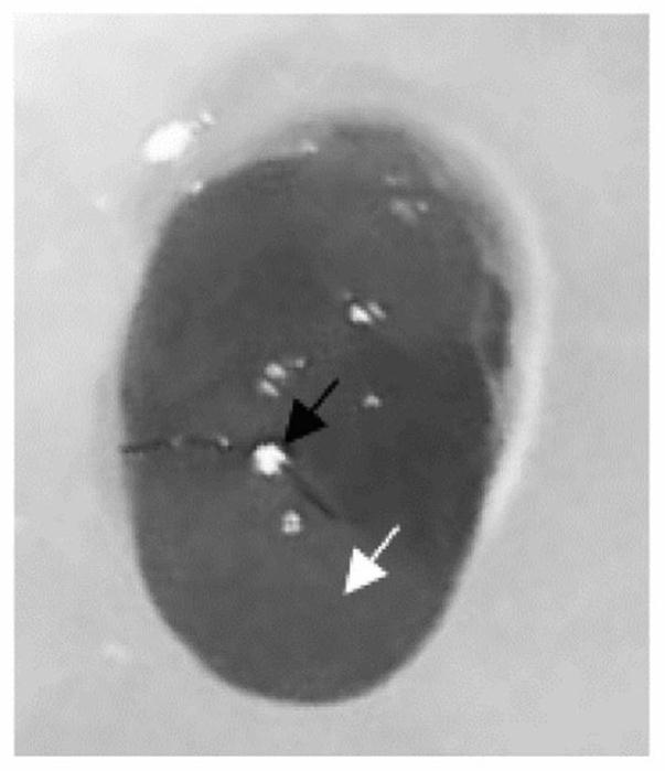 Application of specific protein WIPI1 in early myocardial infarction diagnostic reagent and kit