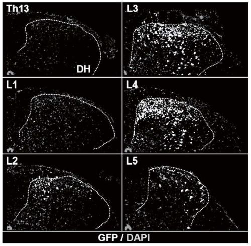 Method and composition for treating neuropathic pain