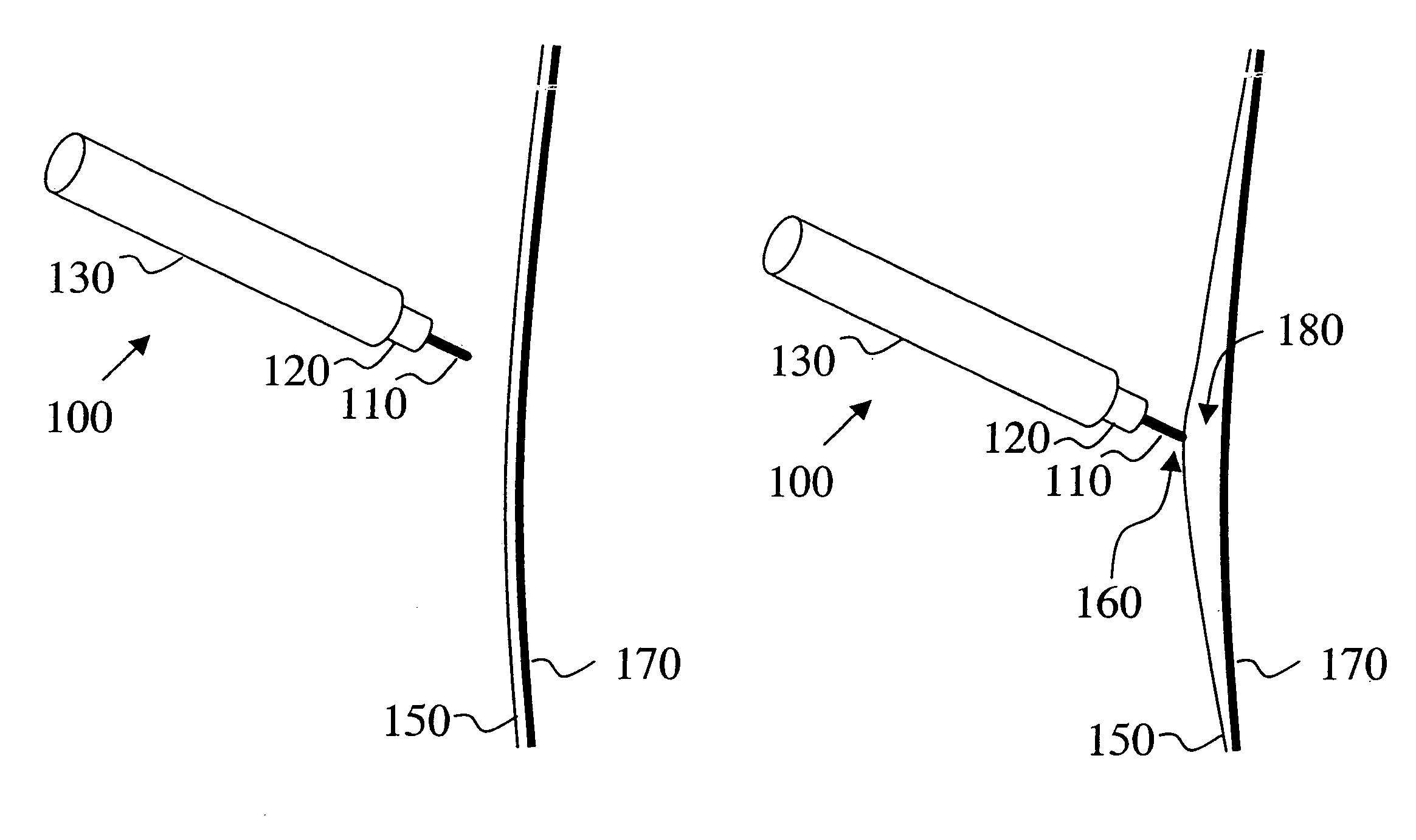 Electro-adhesive tissue manipulation method