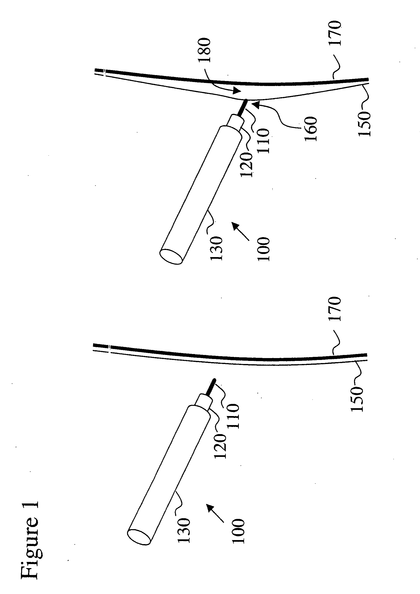 Electro-adhesive tissue manipulation method