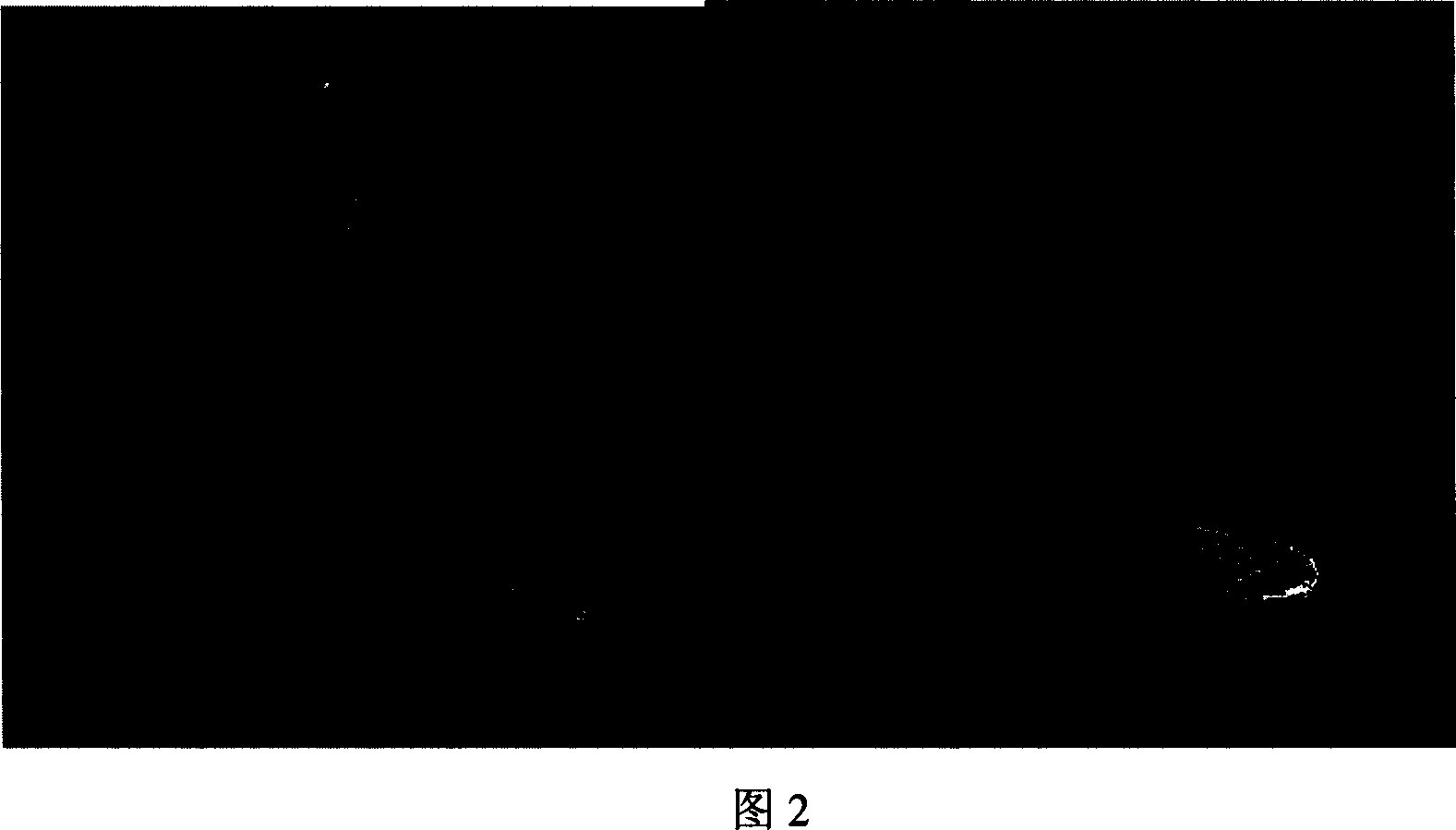 Analysis of sea-horse quantitative shape in magnetic resonance image