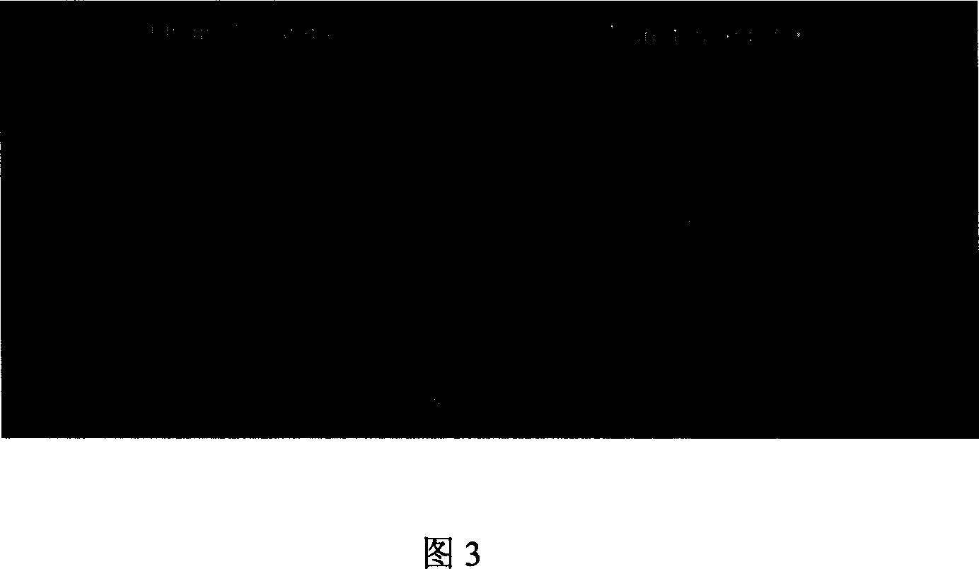 Analysis of sea-horse quantitative shape in magnetic resonance image