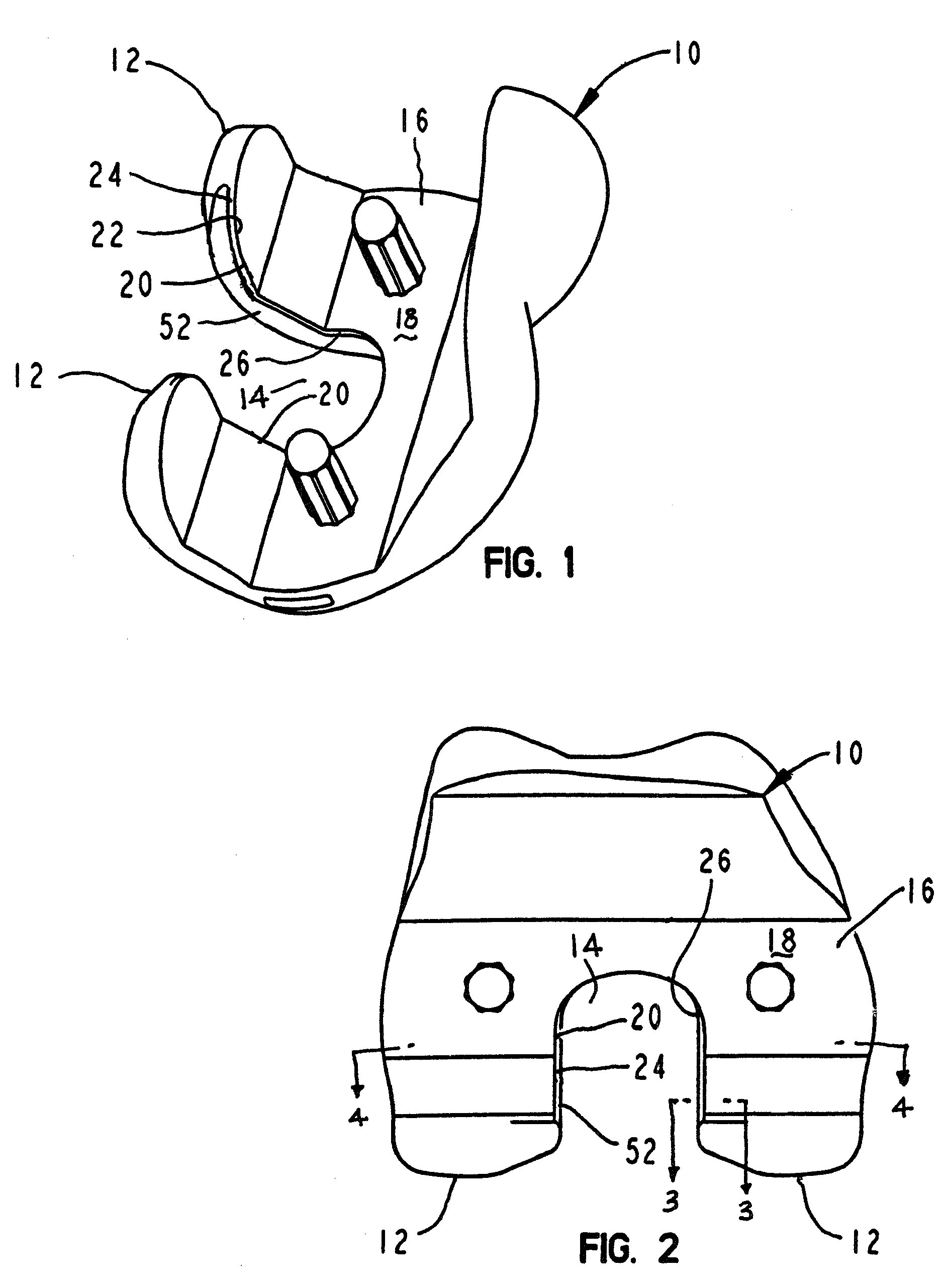 Soft tissue deflection at a prosthetic joint