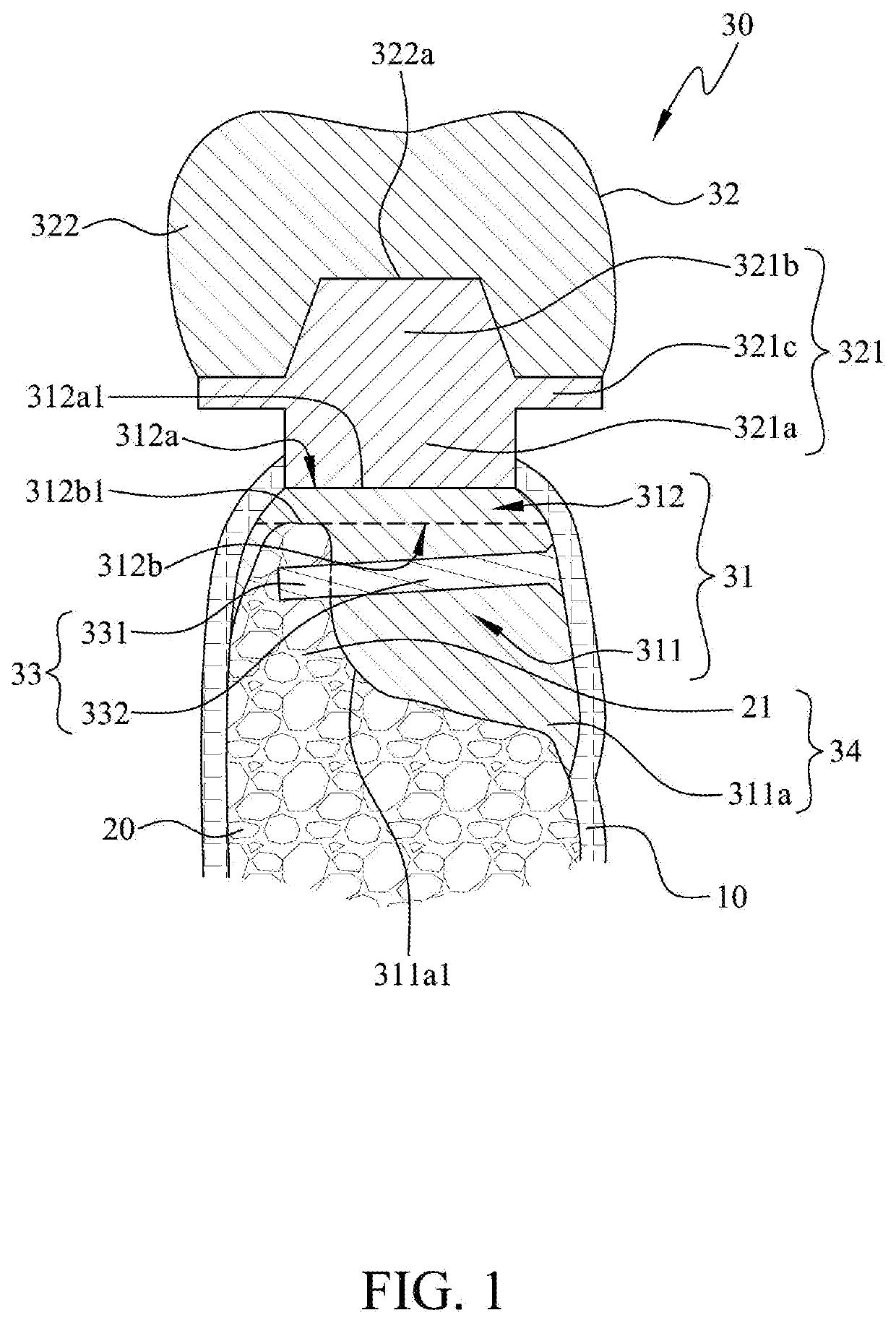 Bone-bonded artificial tooth structure