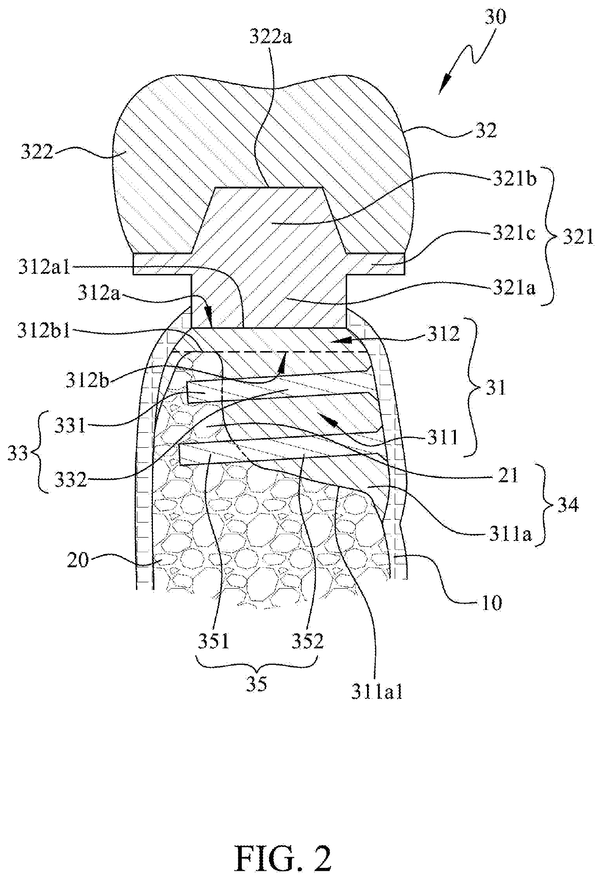 Bone-bonded artificial tooth structure