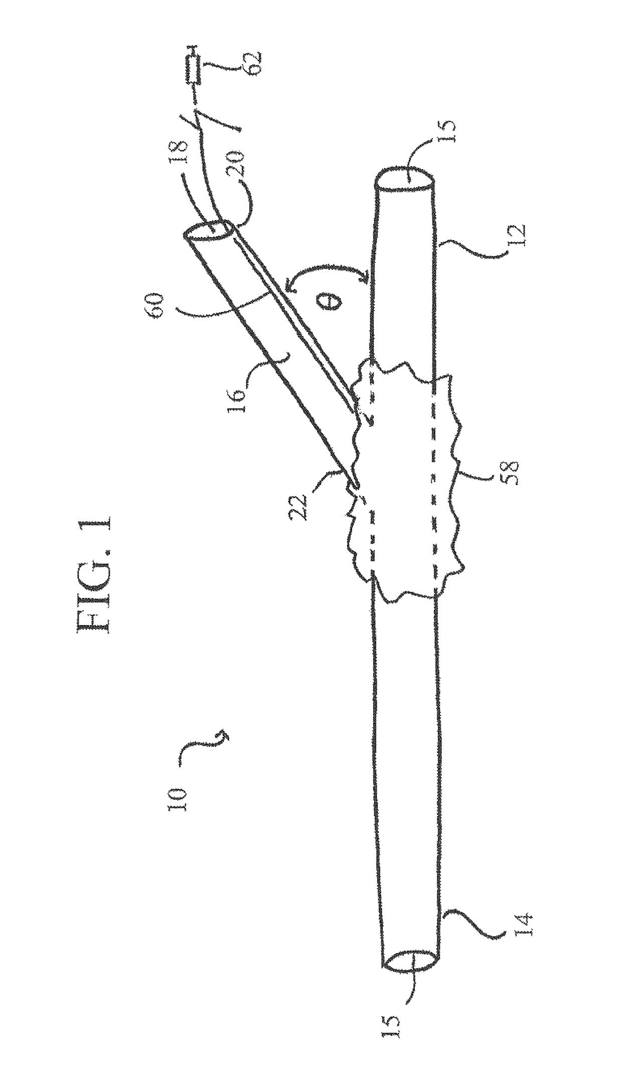 Systems, devices, and methods for organ retroperfusion along with regional mild hypothermia