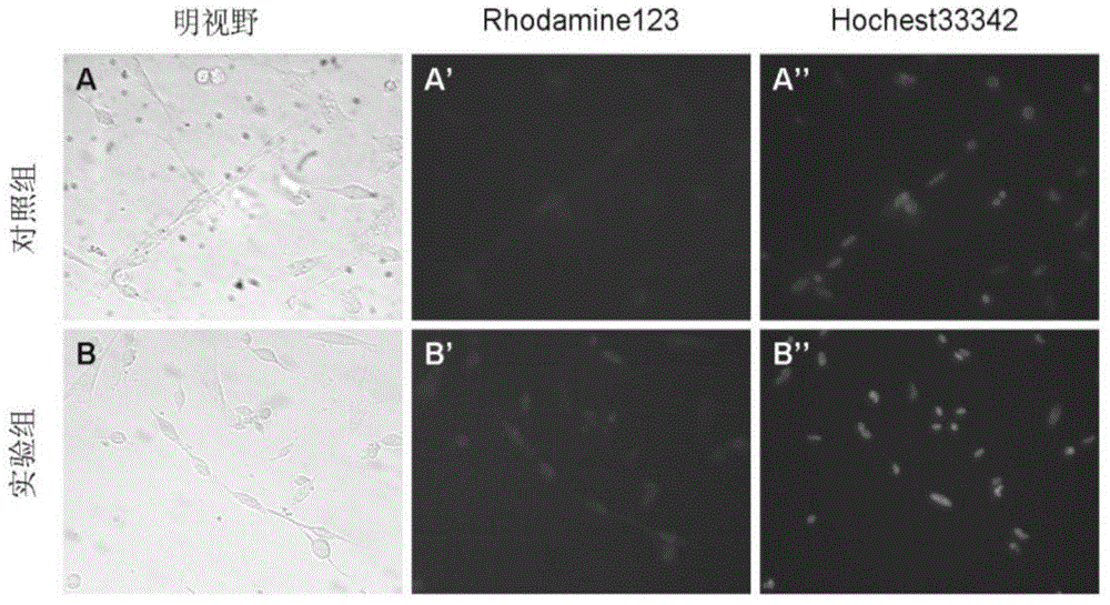 Culture method for improving oxidative metabolic capability of chicken skeletal muscle cells