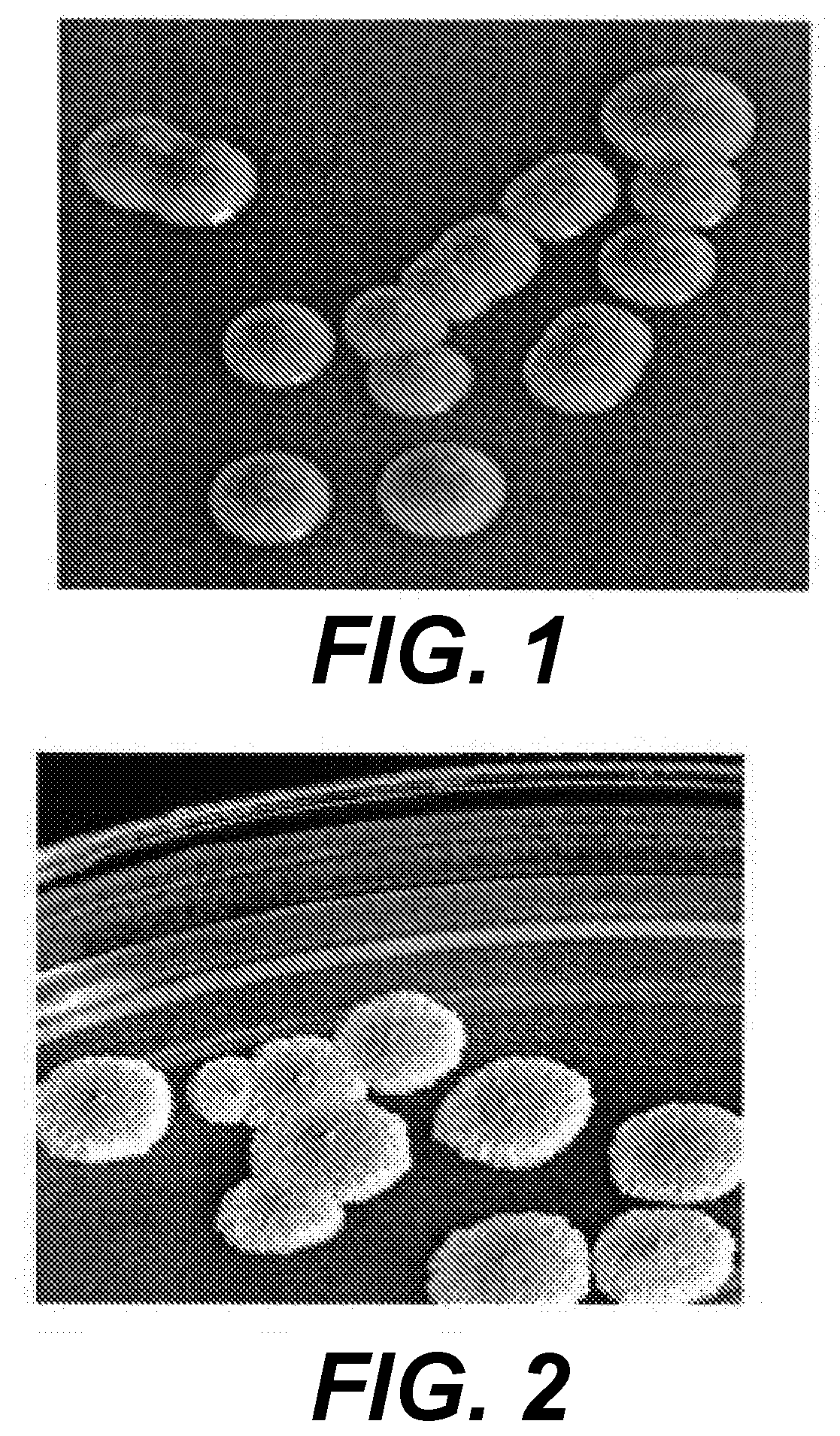 Treatment of Warts