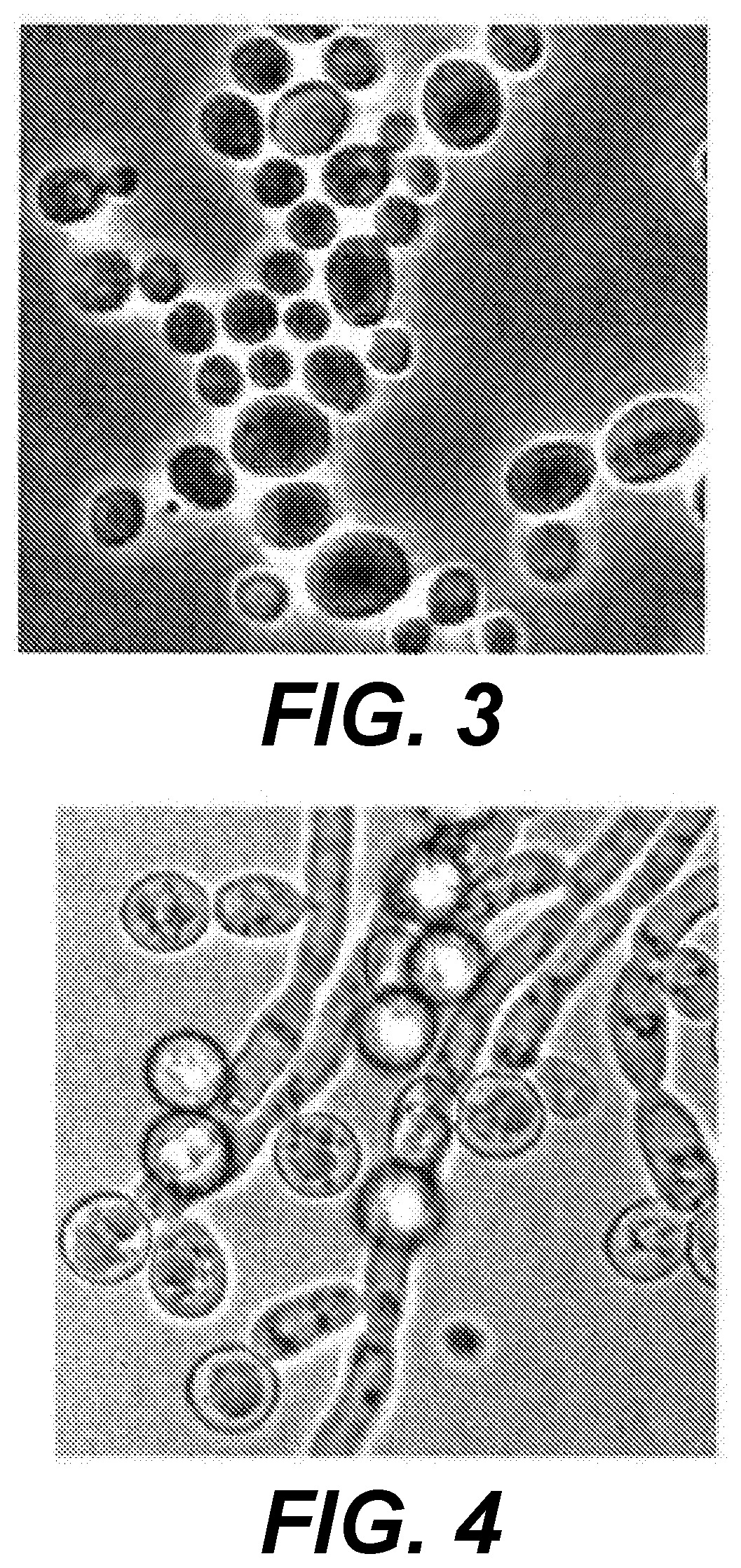 Treatment of Warts