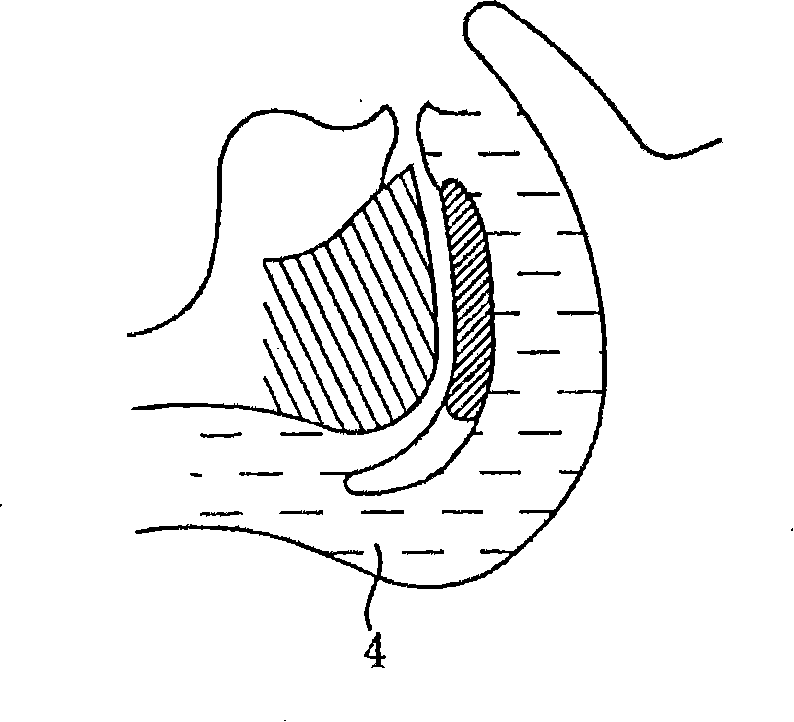 Apparatus for preventing snoring and method using same