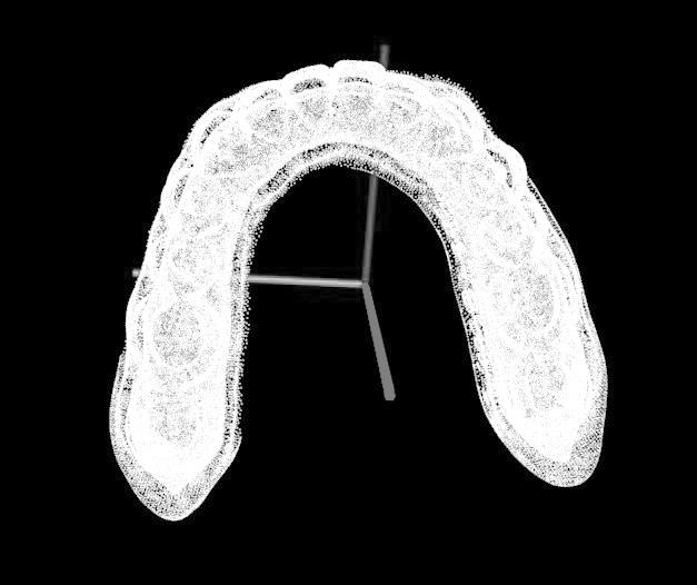 Automatic extraction method of gum line based on digital tooth model