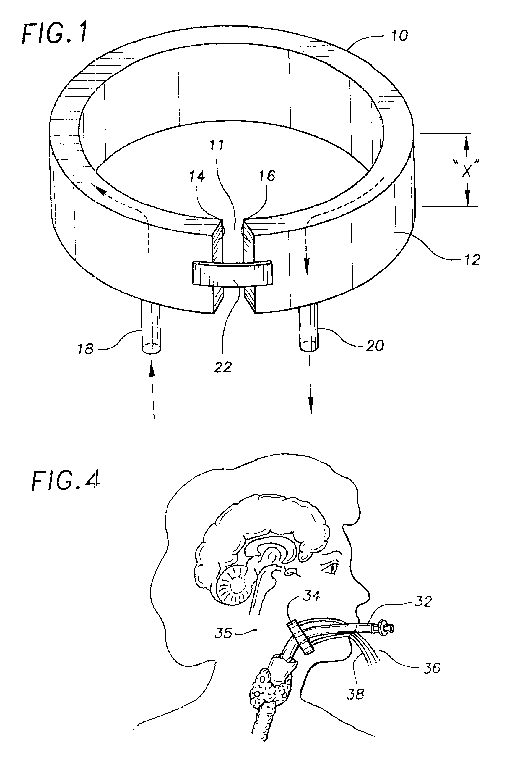 Apparatus for rapid cooling of the brain and method of performing same