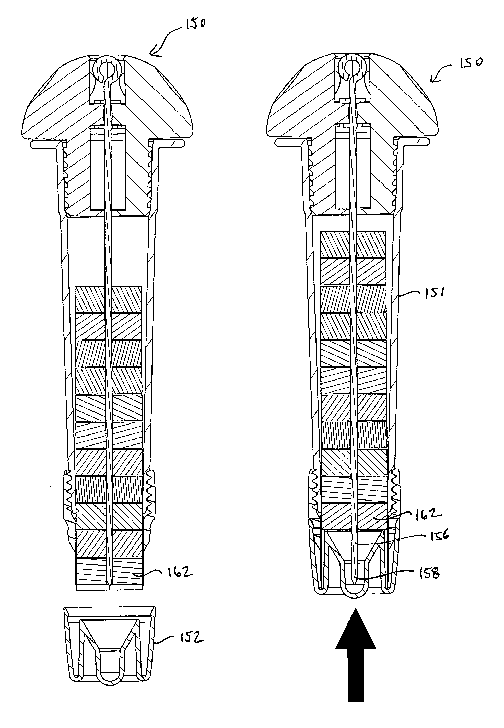 Food preparation device