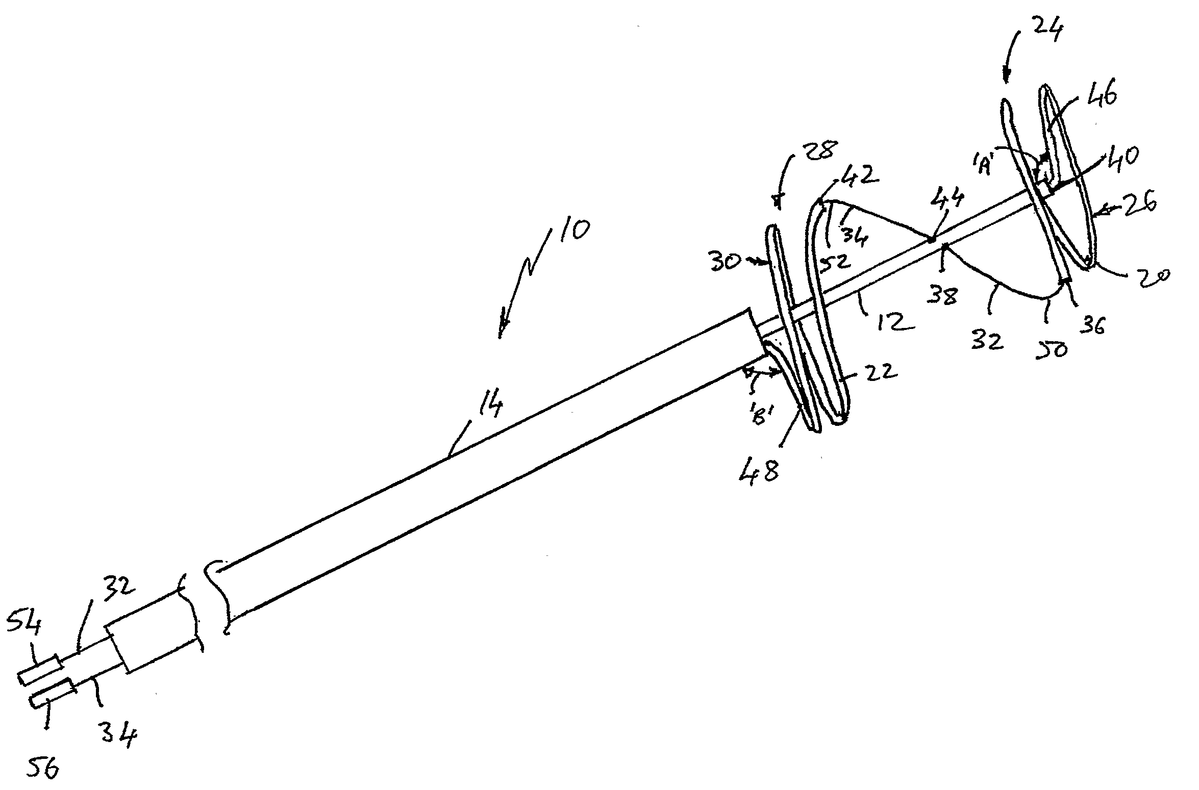 Catheter Assembly With an Adjustable Loop