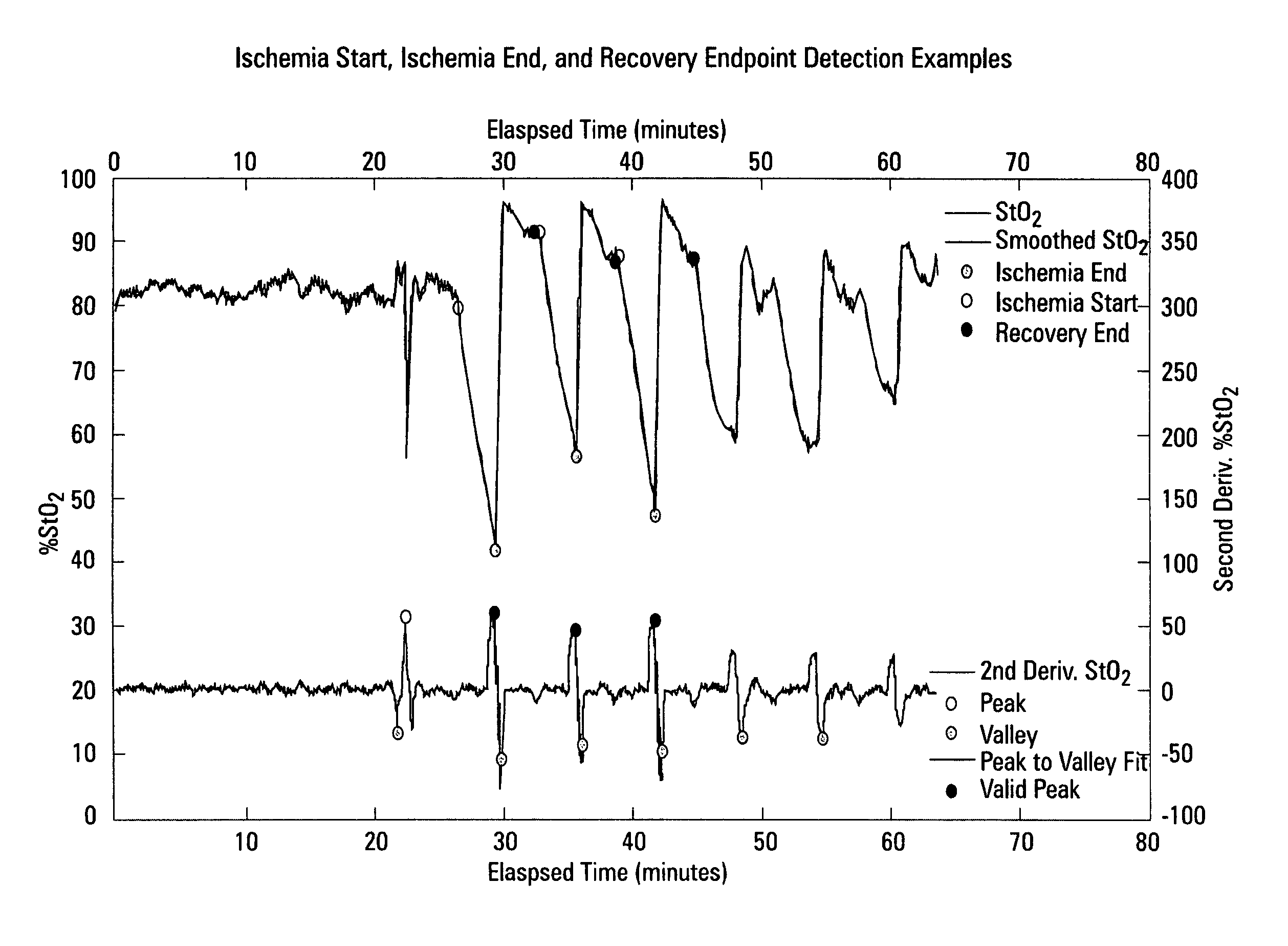 Dynamic StO2 measurements and analysis