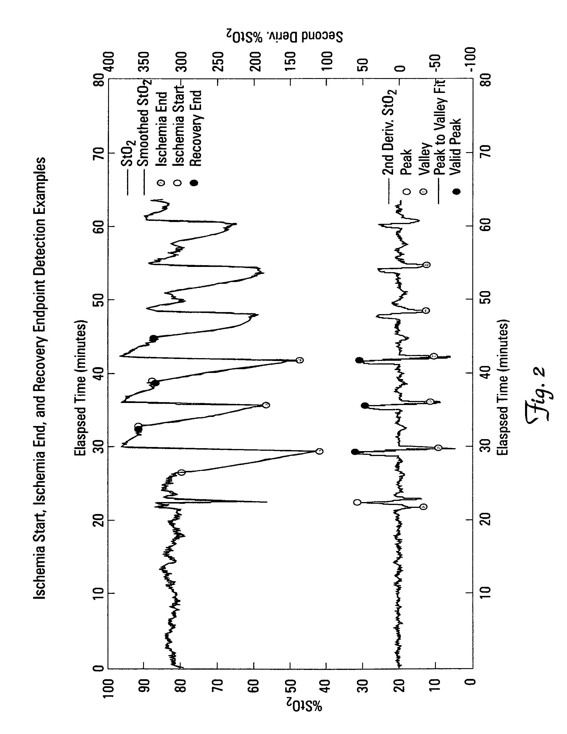 Dynamic StO2 measurements and analysis