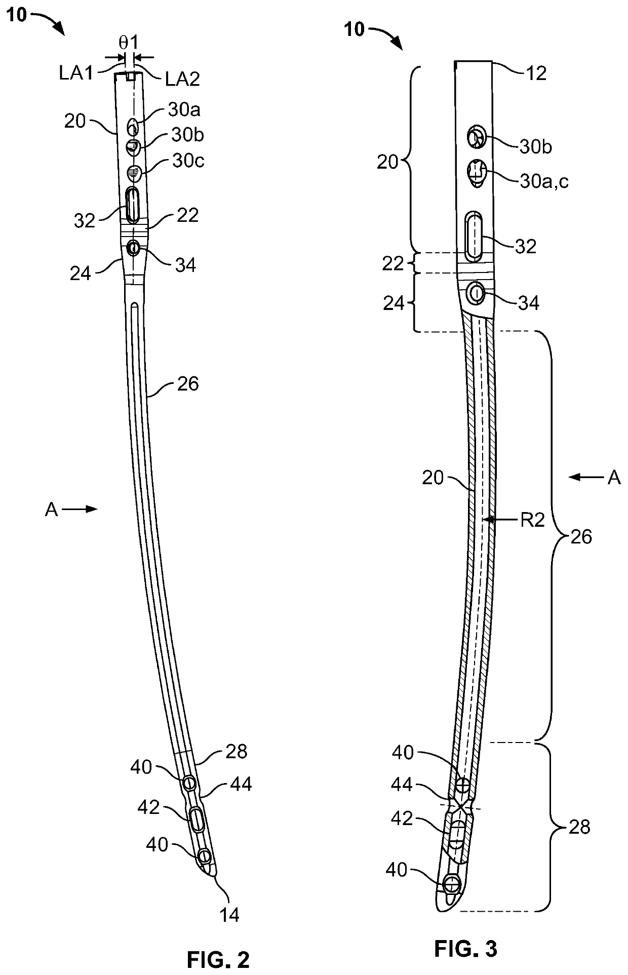 Femoral nail with enhanced bone conforming geometry