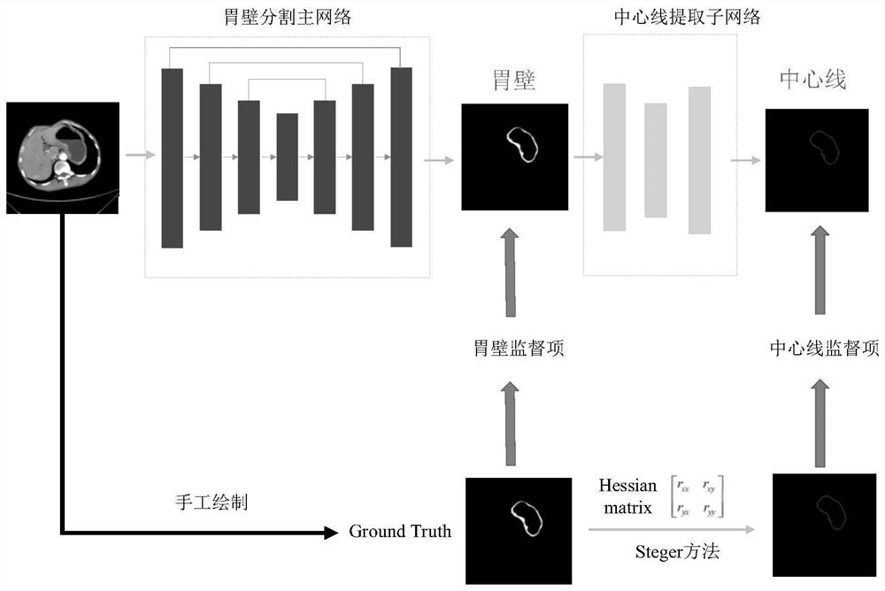 Intelligent gastric cancer staging method based on CT image