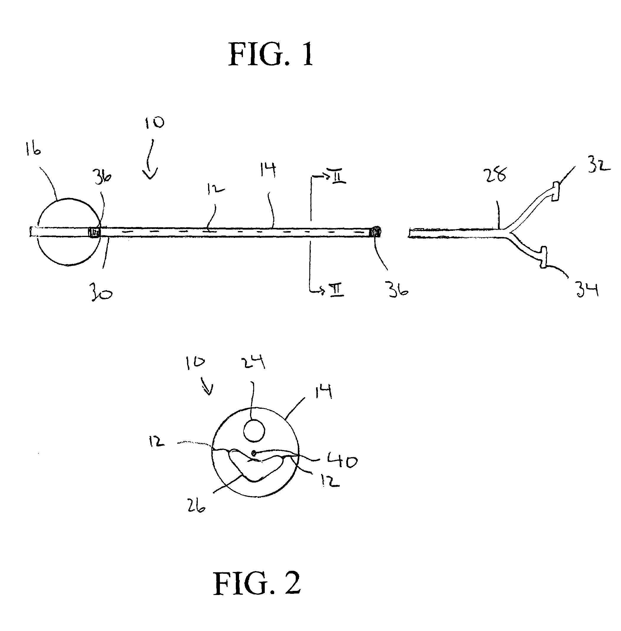 Method and apparatus for treatment of thrombosed hemodialysis access grafts