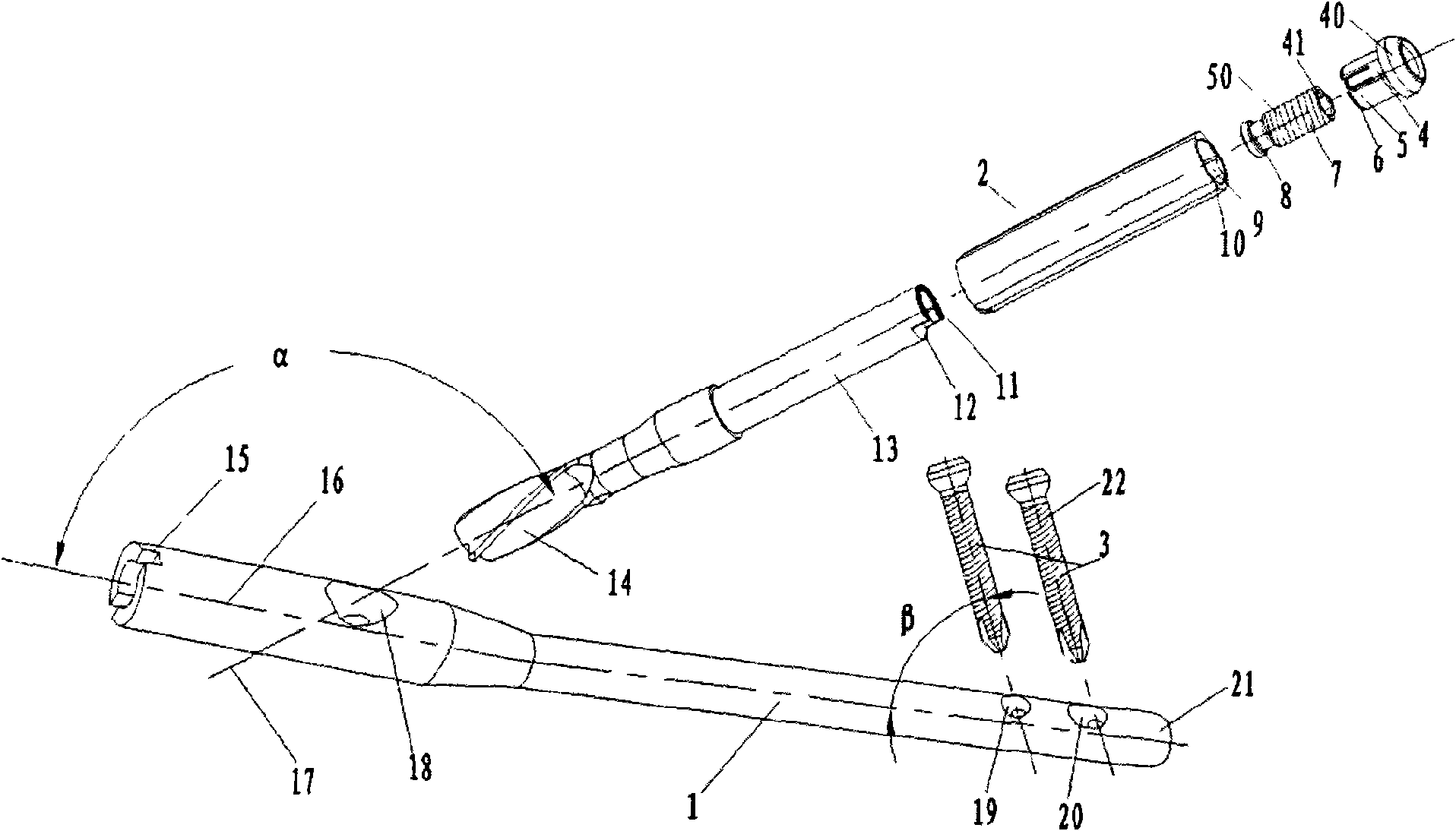 Intramedullary nail fixation device for fractured near end of thighbone