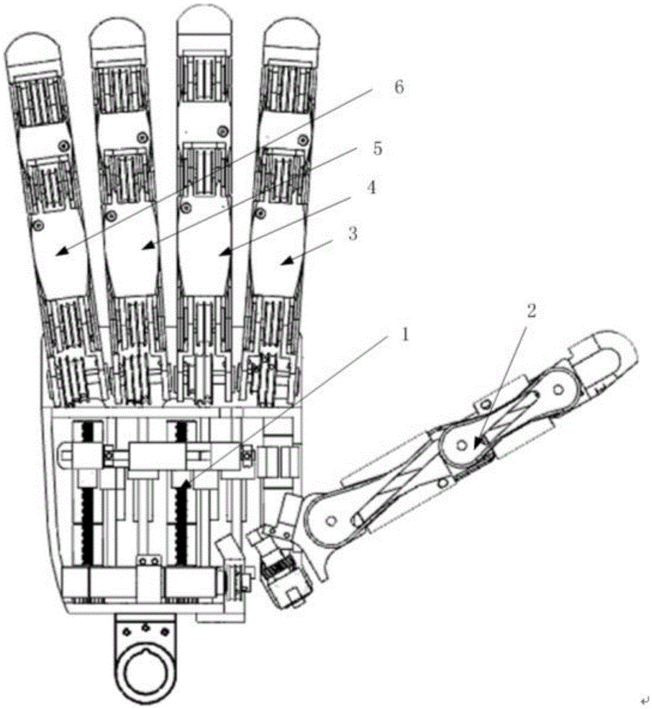 An underactuated prosthetic hand that reproduces the grasping function of the human hand