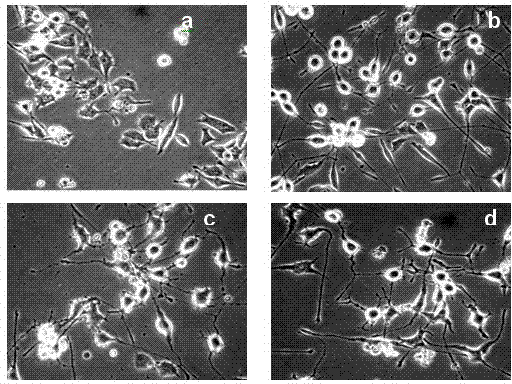 Preparation method and application of active component of radix gentianae extractive