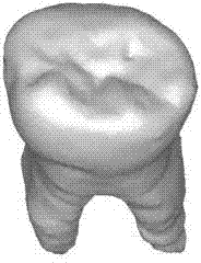 Tooth preparation-based data flexible fusion method