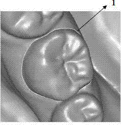 Tooth preparation-based data flexible fusion method