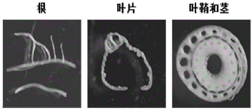 Endosperm-specific expression promoter derived from rice and its application