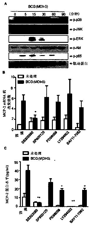 Monocyte chemoattractant protein (MCP) 2 used as marker for tubercular hydrothorax detection, and applications thereof