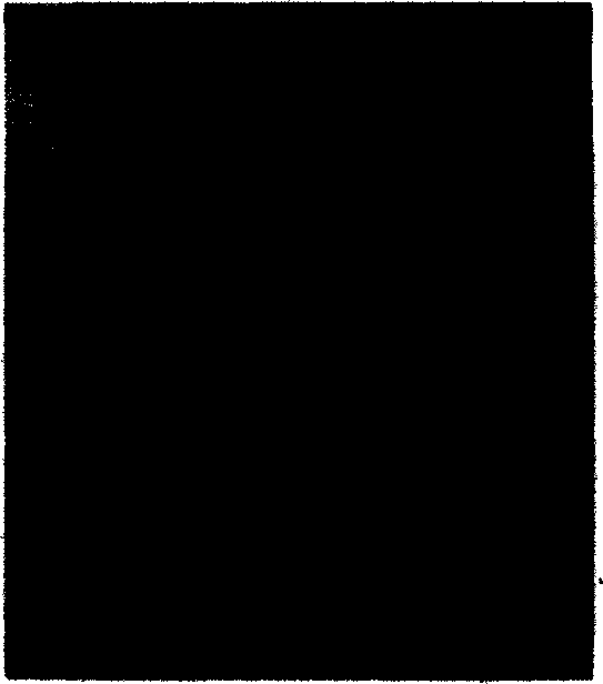 Method of biological tissue optical and ultrasonic collection and tomographic imaging and its device