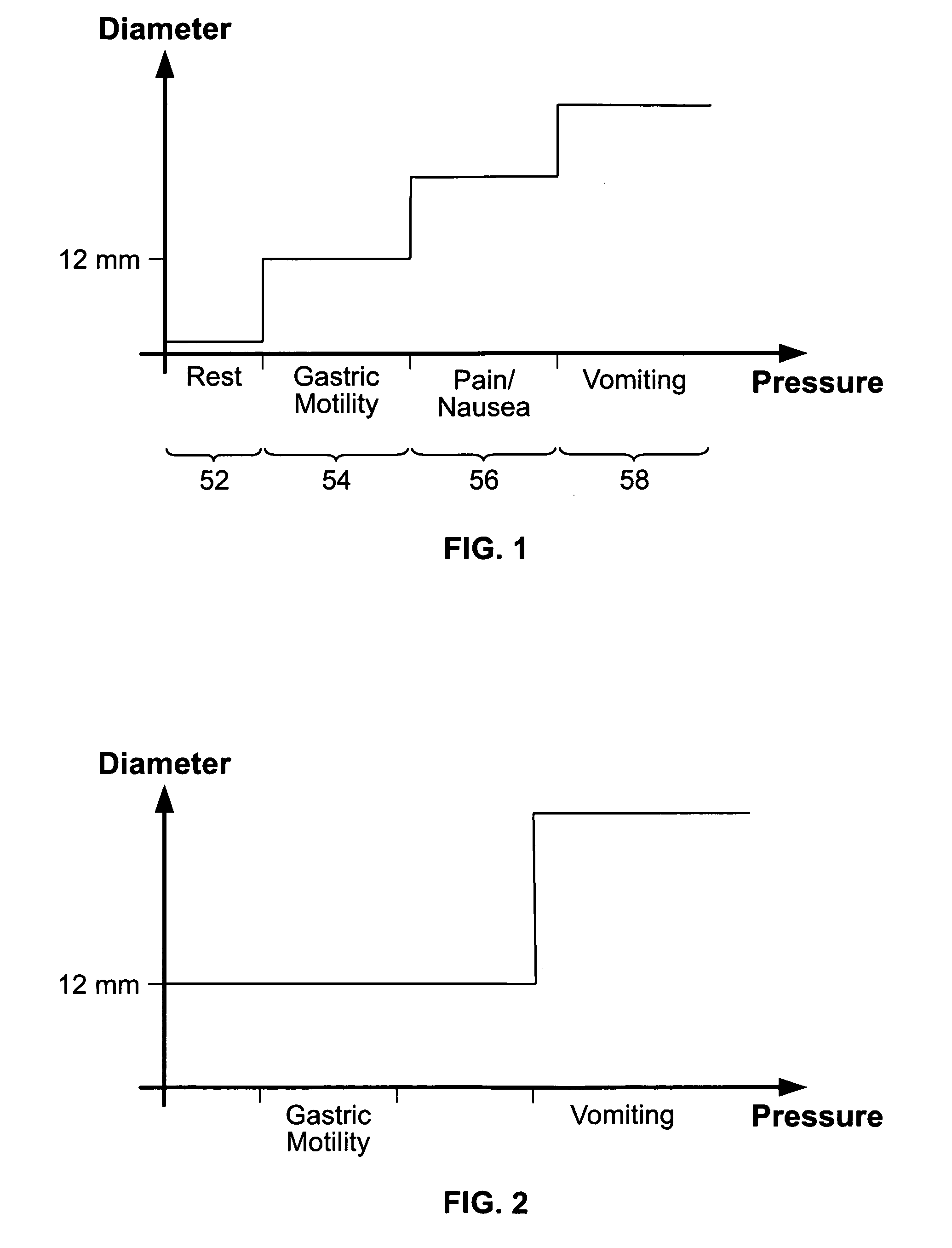 Magnetic gastric band or the like, and related methods