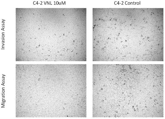 Application of aryl naphthalene type lignan in preparation of medicine for resisting prostate cancer