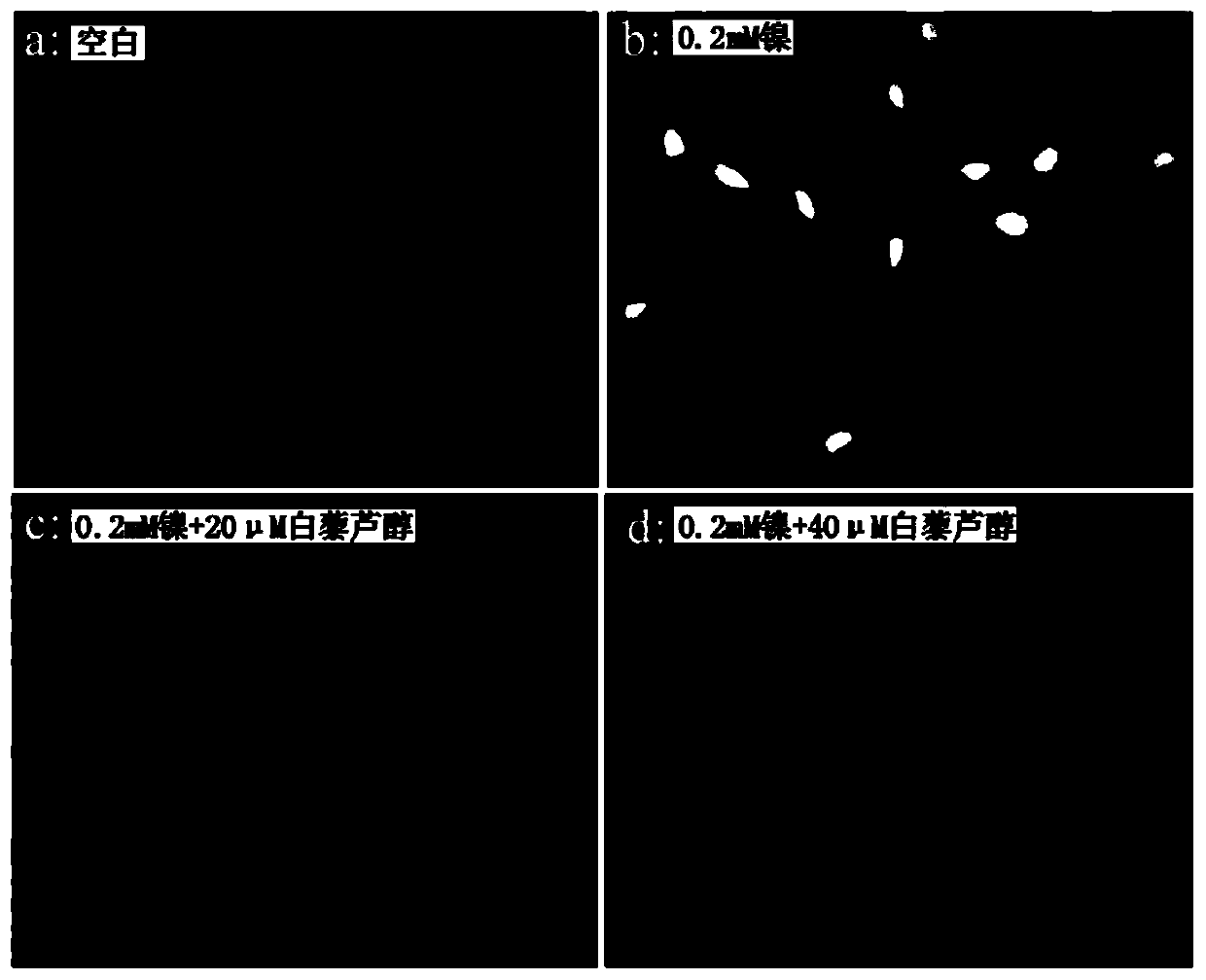 Application of resveratrol in preparation of drugs for treatment of human bronchial epithelial cell injury