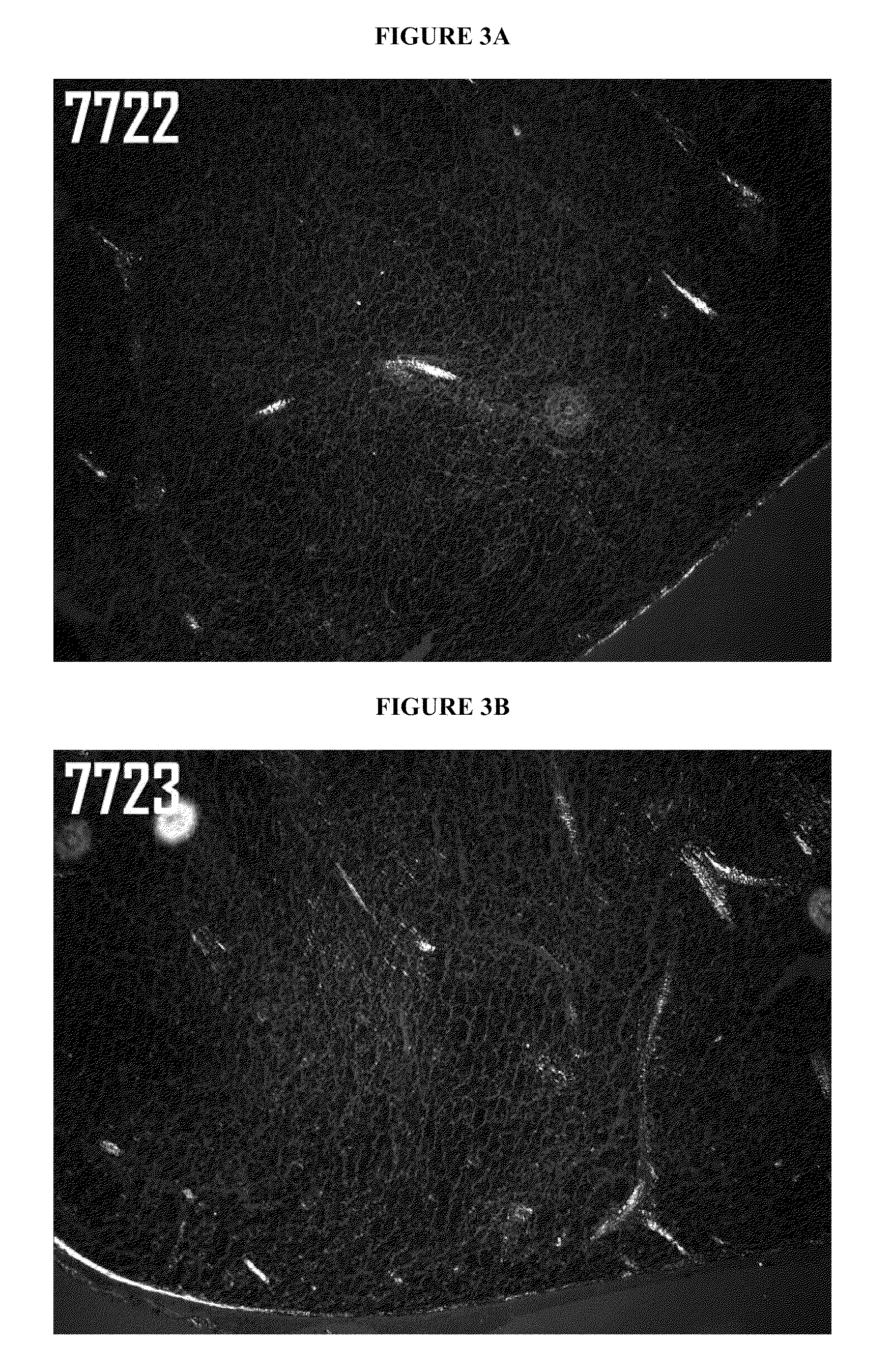 Combinations of SAP depleting agents and anti-SAP antibodies