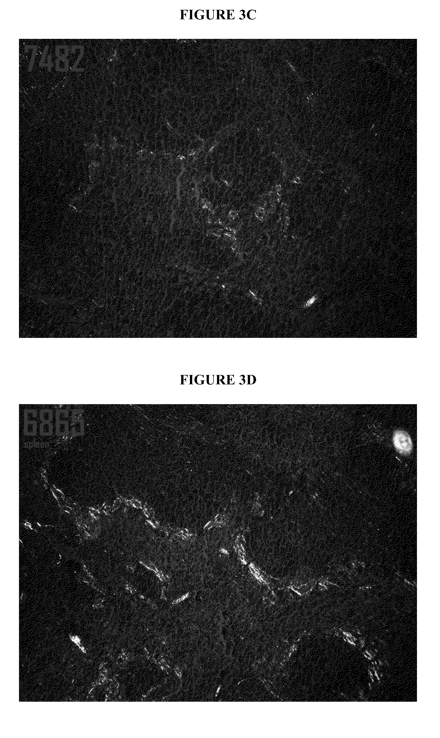 Combinations of SAP depleting agents and anti-SAP antibodies