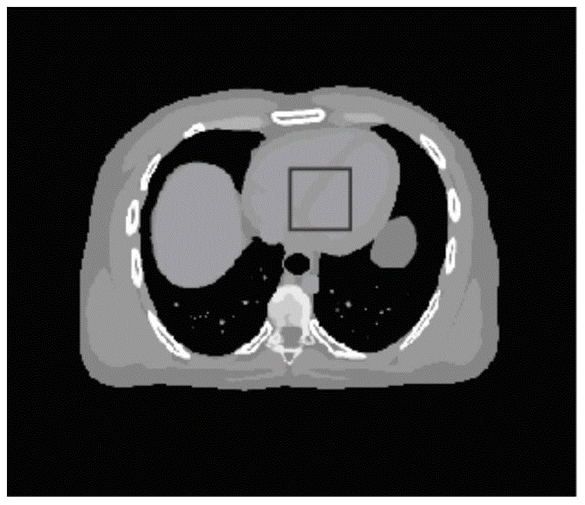 A Statistical Iterative Reconstruction Method of Sparse Angular X-ray CT Images