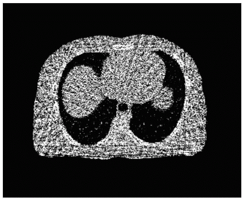 A Statistical Iterative Reconstruction Method of Sparse Angular X-ray CT Images