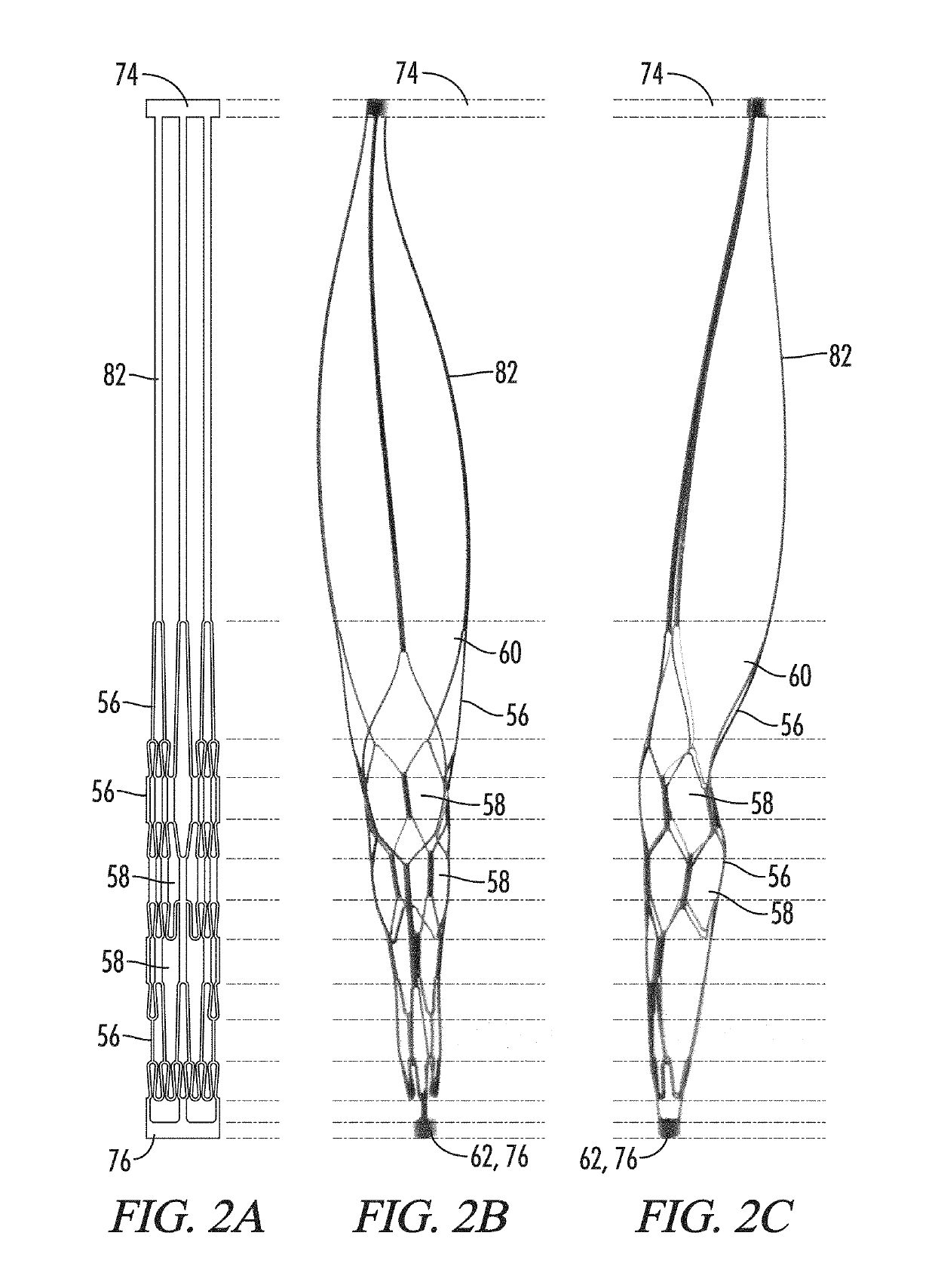 Clot retrieval system