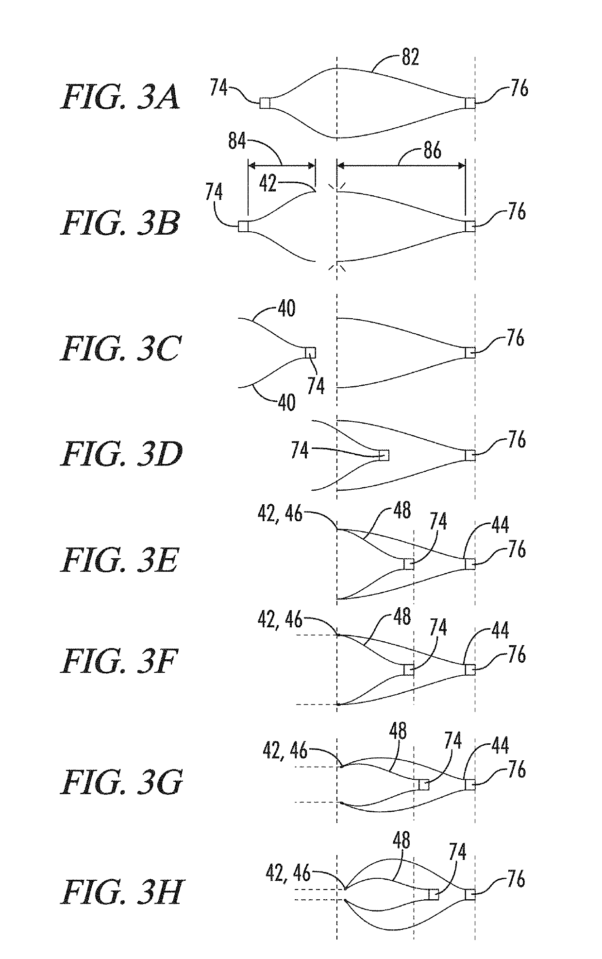 Clot retrieval system