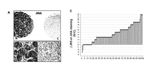 A kit for detecting jwa expression in cancer or malignant tumor tissue