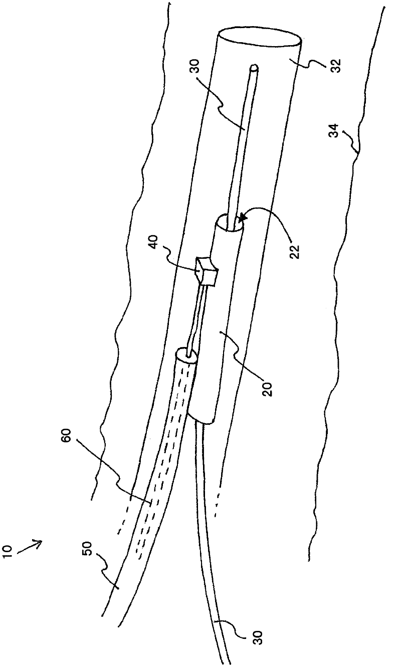 Physiological sensor delivery device and method