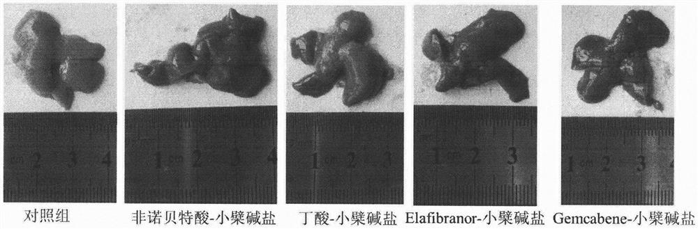 Acid-base addition salt containing berberine, preparation method of acid-base addition salt and application of acid-base addition salt as medicaments