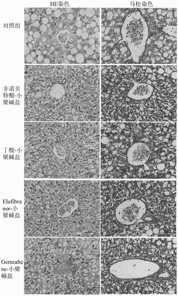 Acid-base addition salt containing berberine, preparation method of acid-base addition salt and application of acid-base addition salt as medicaments