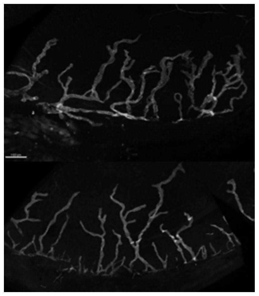 Corneal neovascularization/lymphatic vessel generation injury model and construction method and application thereof