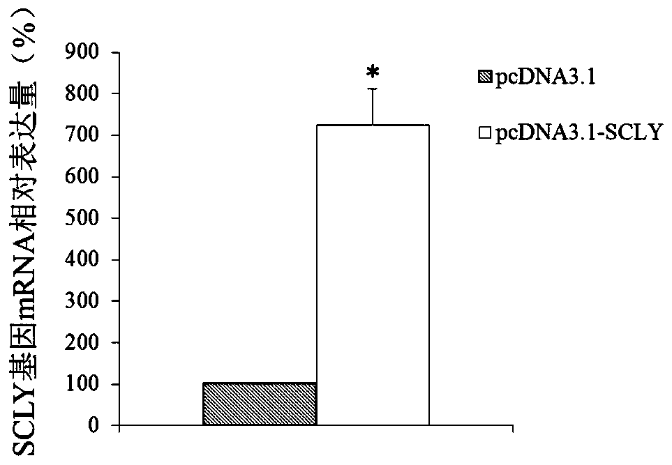 Diagnosis and treatment markers of hypopharyngeal carcinoma and its application