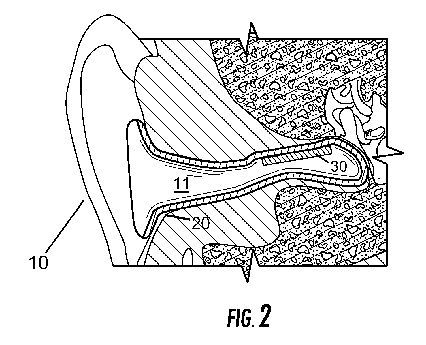 Vestibular stimulation apparatus and associated methods of use