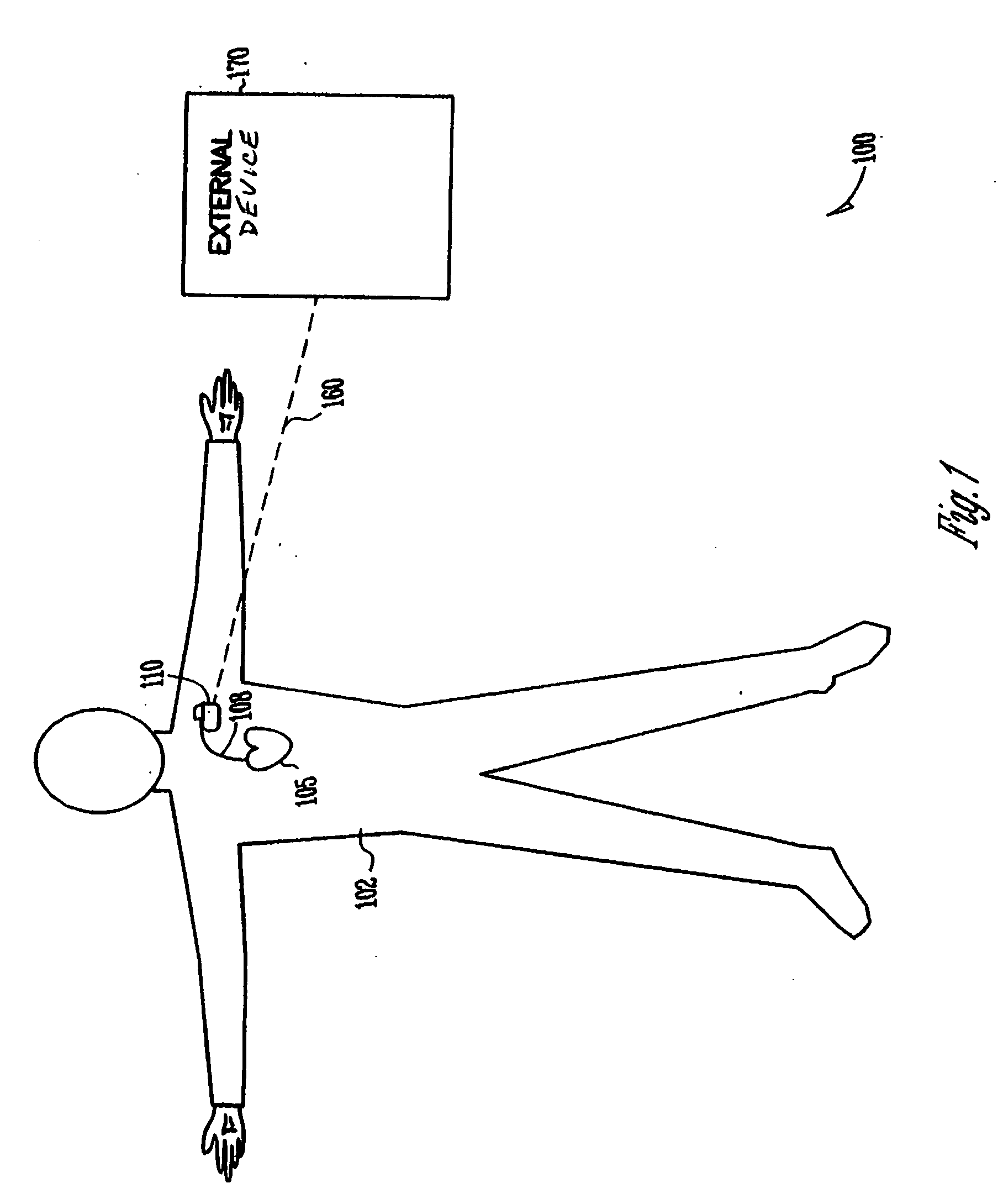 Adaptive software configuration for a medical device