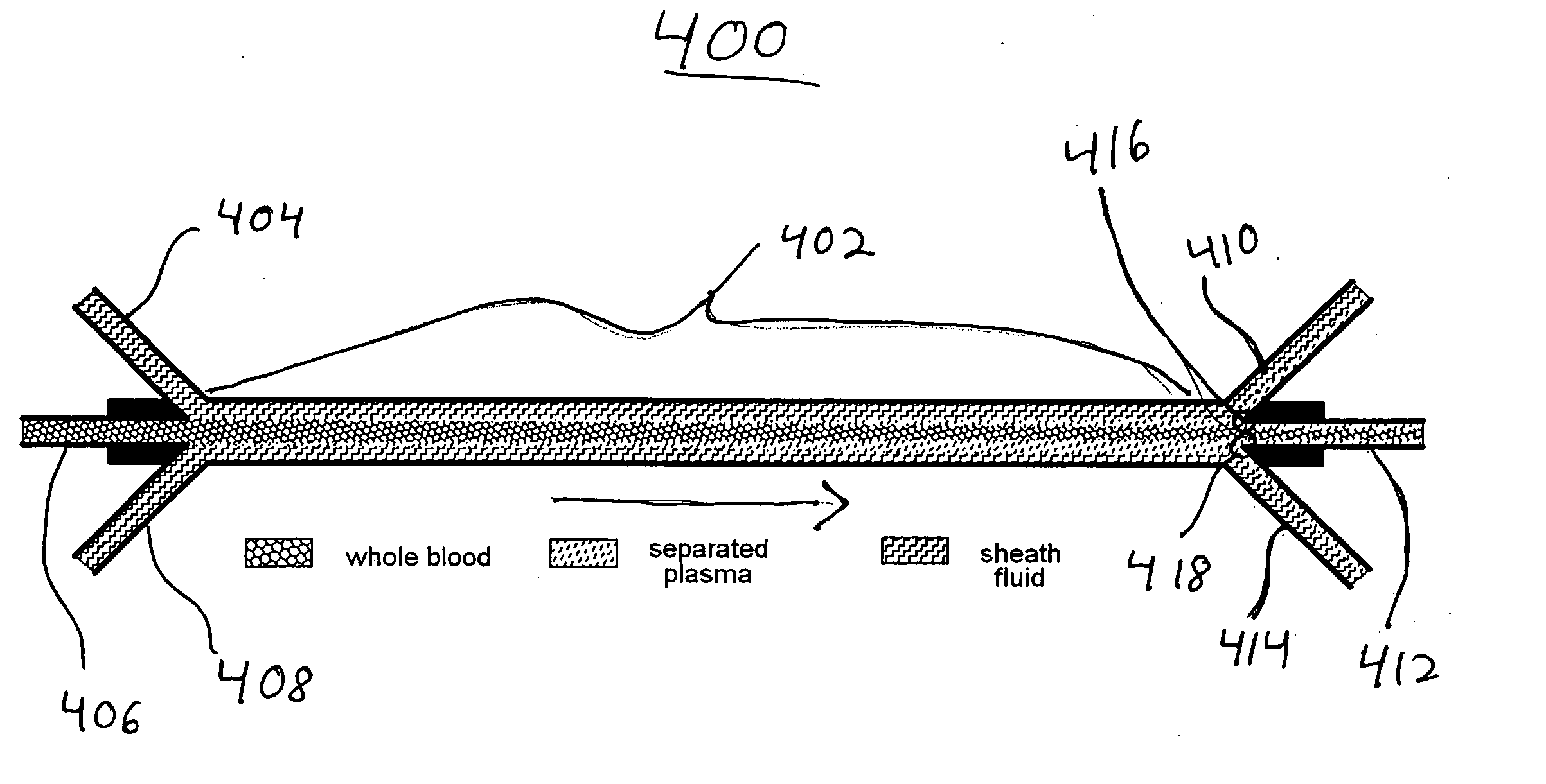 Systems and methods of blood-based therapies having a microfluidic membraneless exchange device