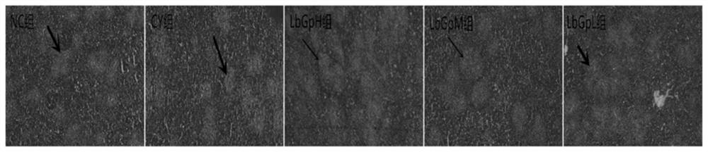 Immunological enhancement composition and application thereof